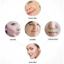 Electroderm Portabil Cosmetica cu 4 Capete Lumina Mov (Anti-Acnee) - 11
